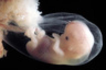 Human fetus enclosed in the amniotic sac during the eighth week of development --- Image by © Leemage/Corbis