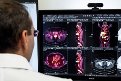 Нечем дышать. Как кислород влияет на агрессивность раковых опухолей