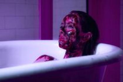 «Это какая-то глупость» Как зумеры калечат себя ради красоты и лайков в TikTok? Мнение врачей