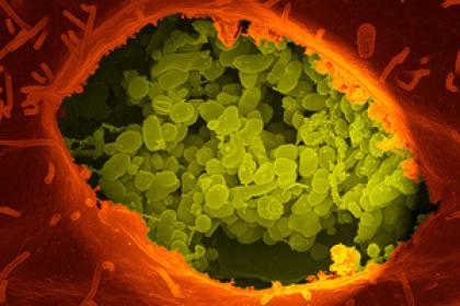 Протечка мозгов Как кишечная флора контролирует человека