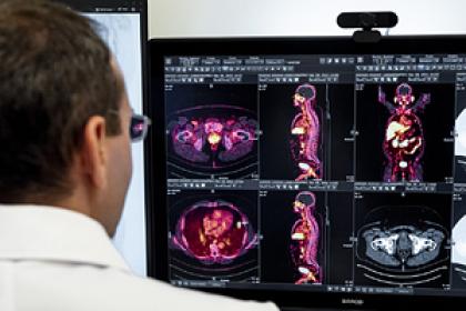 Нечем дышать. Как кислород влияет на агрессивность раковых опухолей